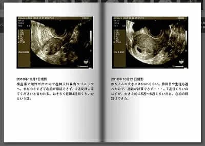 エコー写真のアルバム作成例
